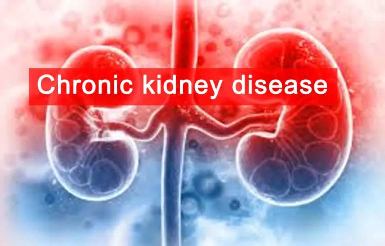 Chronic Kidney Disease